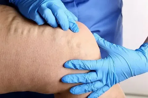 angiologista e cirurgião vascular